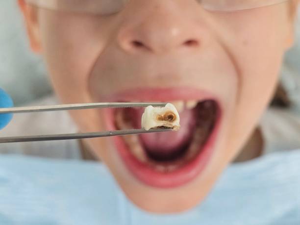Best Urgent Dental Care for Toothache in Ripley, WV
